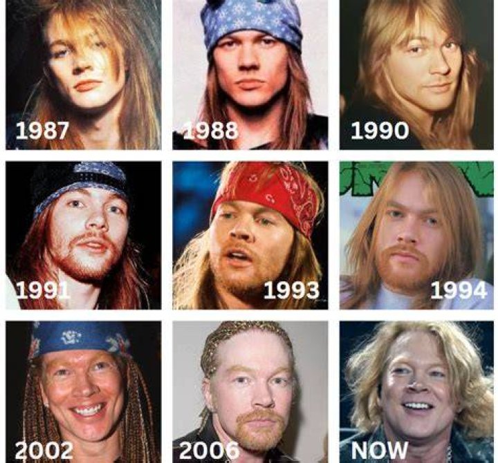 AXL ROSE NOW: THE EVOLUTION OF ROCKS ICONIC FRONTMAN