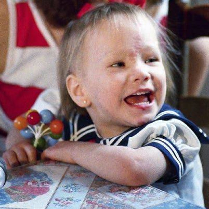 Baby Jessica Injuries: A Closer Look at the Truth Behind the Headlines