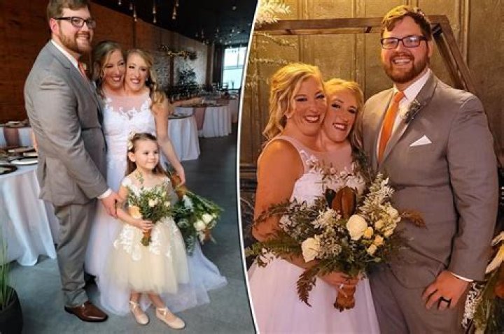 Conjoined Twins Wedding: Celebrating Love Beyond Boundaries