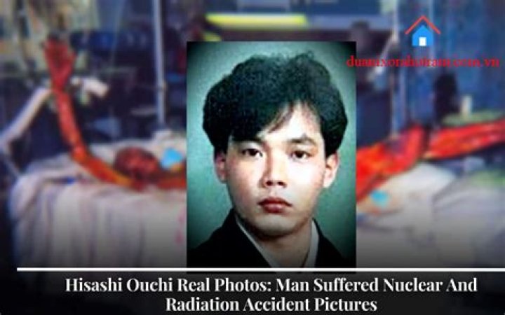 Hisashi Ouchi Real Photos: Uncovering the Truth Behind a Tragic Story