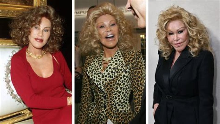 Jocelyn Wildenstein's Early Years: A Journey Through Glamour and Transformation