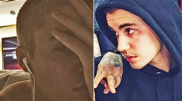 Justin Bieber Face Tattoo: The Untold Story Behind the Ink