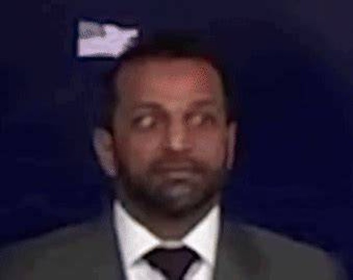 Kash Patel Eyes Condition: The Inside Scoop You Need to Know