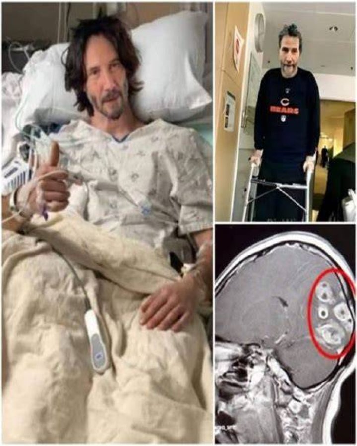 Keanu Reeves Cancer: The Journey of Strength and Resilience