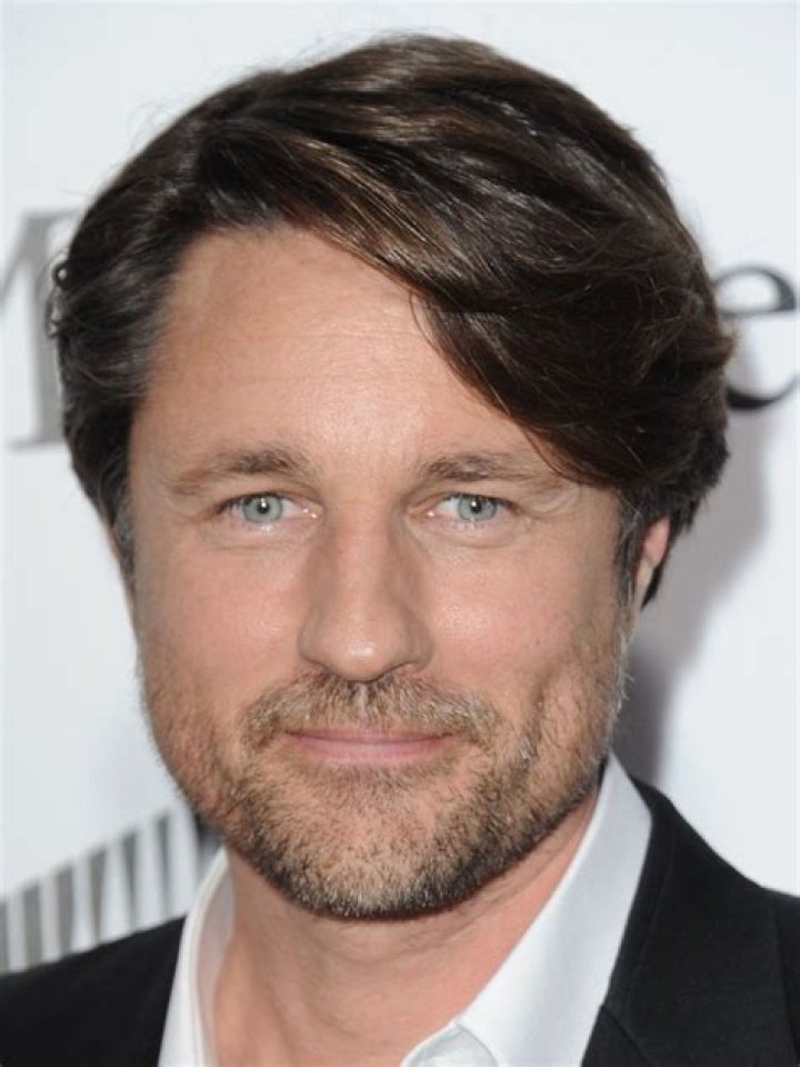 Martin Henderson Face Change: The Story Behind the Transformation