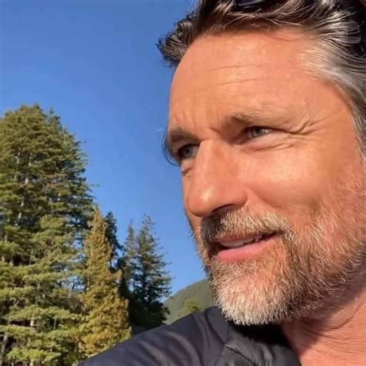 Martin Henderson Face Work: The Ultimate Guide to His Stunning Transformation
