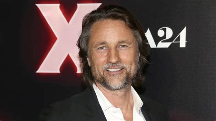 Martin Henderson Facial Surgery: The Untold Story Behind the Transformation