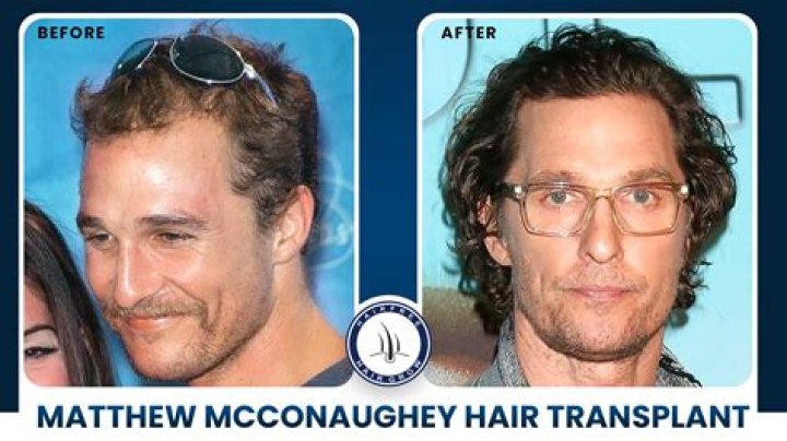 Matthew McConaughey Hair: A Comprehensive Exploration
