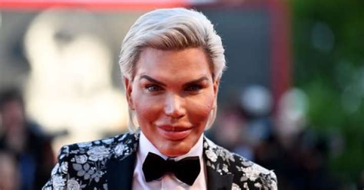 Rodrigo Alves: The Plastic Surgery King's Journey and His Impact on the Beauty Industry