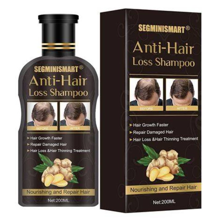 Shampoo to Prevent Hair Loss: Your Ultimate Guide to Stronger, Healthier Hair