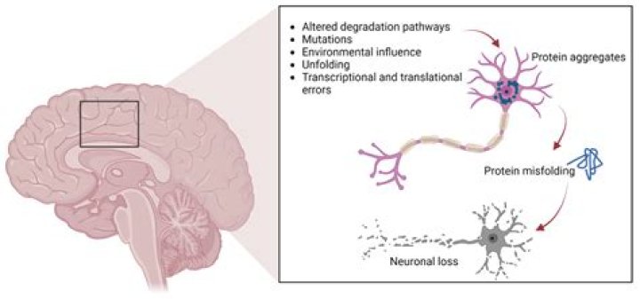 Understanding ATPL Disease in the Brain: Causes, Symptoms, and Treatments