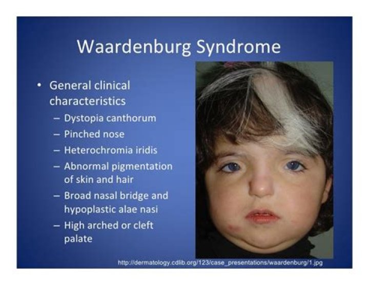 Waardenburg Syndrome: Henning Wehn's Battle and Insights