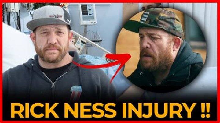 What Happened To Rick Ness Nose