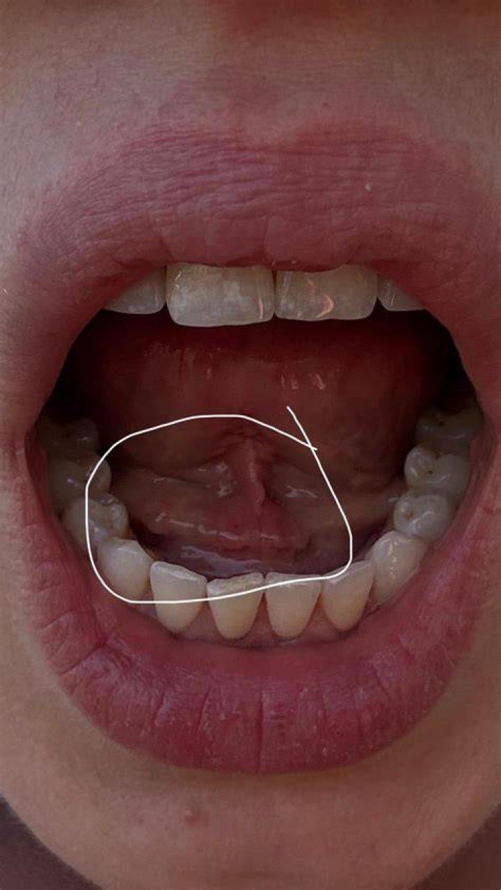 What is Sal Debajo de la Lengua and How Does it Work? Unlocking the Secrets Beneath Your Tongue
